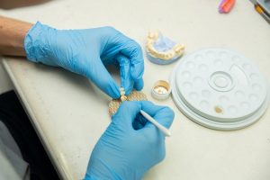 creating a dental implant