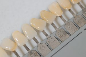 Veneers choices