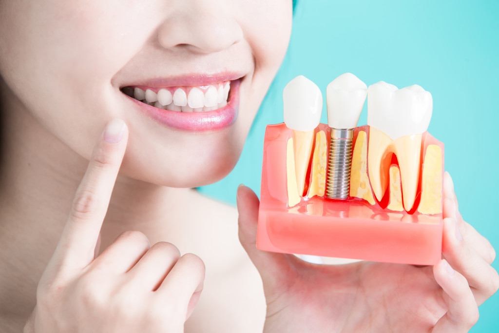demo of dental implants in gum