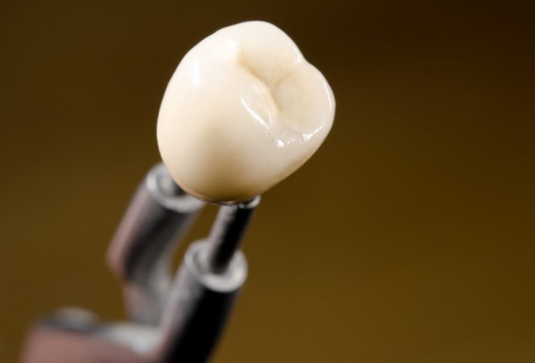 dental crown held on tweezers