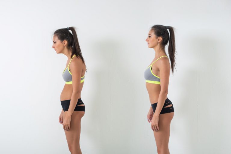 a woman with bad posture