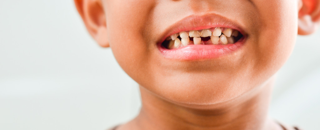 A child with a missing lower tooth