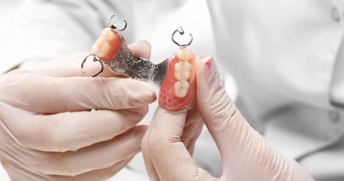 dentures held by dentist